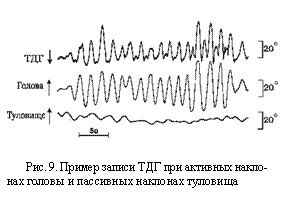 Подпись:  
Рис. 9. Пример записи ТДГ при активных накло¬нах головы и пассивных наклонах туловища
